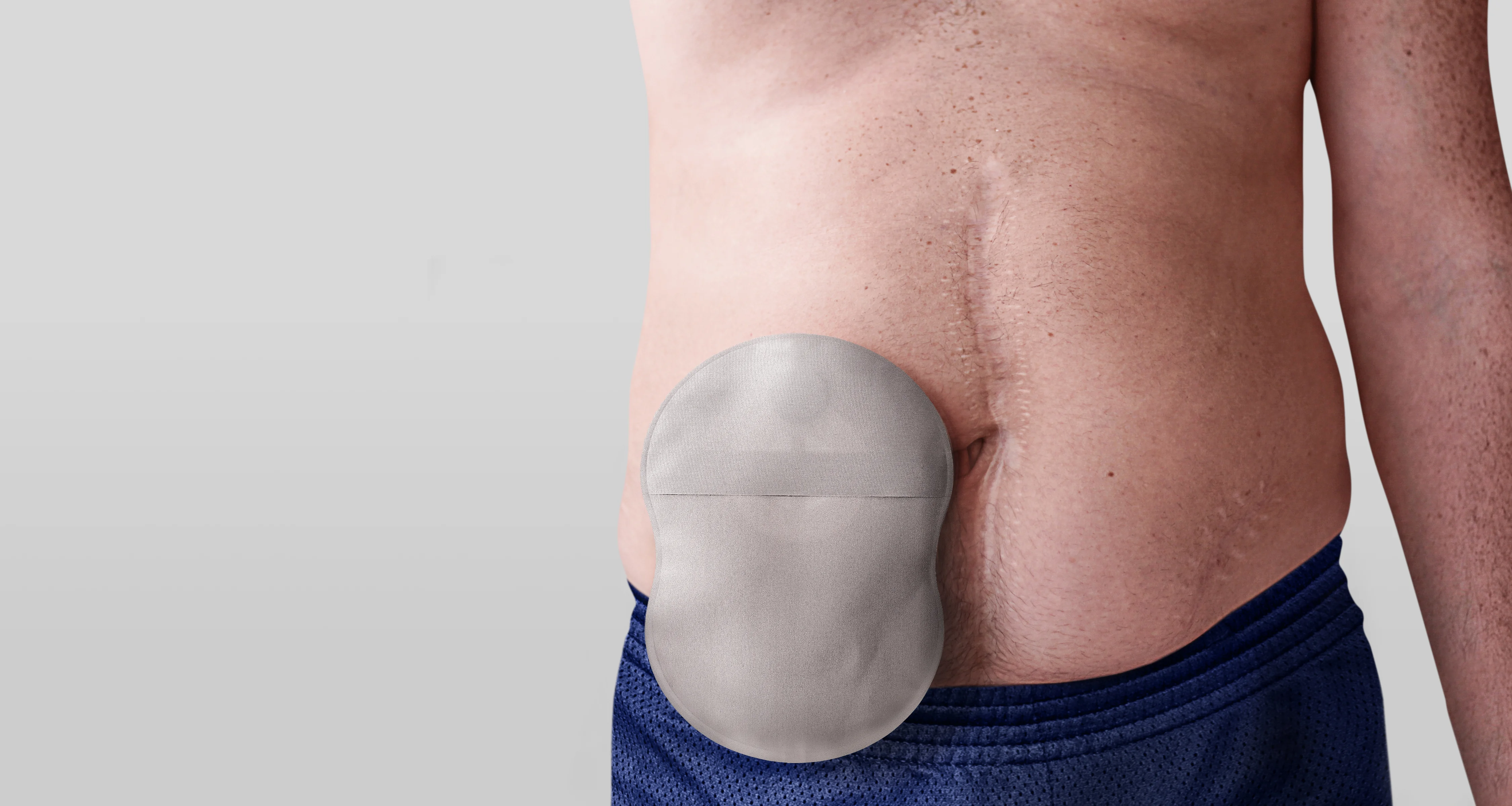 Mand iført en Esteem Body™ stomipose