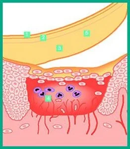 diagramma